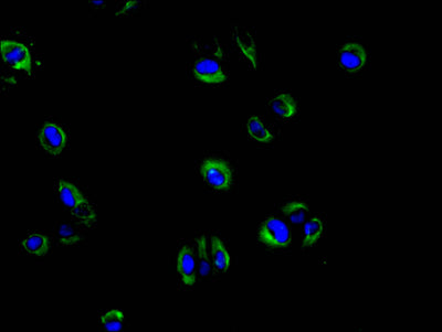 Immunofluorescence staining of Hela cell with IL2RA Recombinant Monoclonal Antibody at 1:30, counter-stained with DAPI. The cells were fixed in 4% formaldehyde and blocked in 10% normal Goat Serum. The cells were then incubated with the antibody overnight at 4C. The secondary antibody was FITC-conjugated AffiniPure Goat Anti-human IgG(H+L).IL2RA Recombinant Monoclonal Antibody