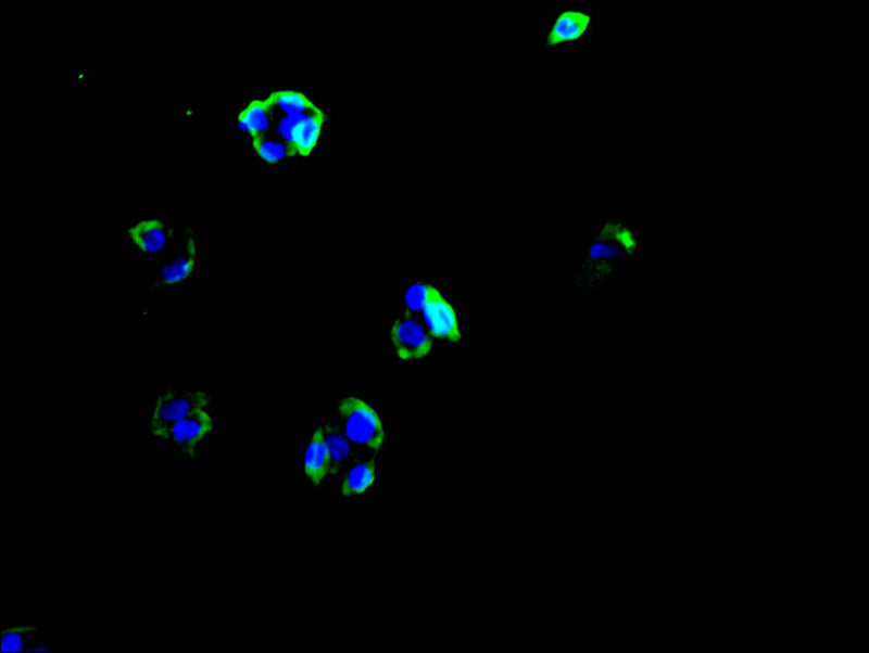 Immunofluorescence staining of HEPG2 cell with IL2RA Recombinant Monoclonal Antibody at 1:30, counter-stained with DAPI. The cells were fixed in 4% formaldehyde and blocked in 10% normal Goat Serum. The cells were then incubated with the antibody overnight at 4C. The secondary antibody was FITC-conjugated AffiniPure Goat Anti-human IgG(H+L).IL2RA Recombinant Monoclonal Antibody