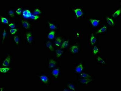 Immunofluorescence staining of Hela cells with ITGB1 Recombinant Monoclonal Antibody at 1:61, counter-stained with DAPI. The cells were fixed in 4% formaldehyde, permeabilized using 0.2% Triton X-100 and blocked in 10% normal Goat Serum. The cells were then incubated with the antibody overnight at 4℃. The secondary antibody was Alexa Fluor 488-congugated AffiniPure Goat Anti-Rabbit IgG (H+L).ITGB1 Recombinant Monoclonal Antibody