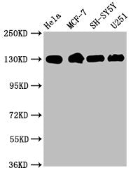 Western Blot | Positive WB detected in: Hela whole cell lysate, MCF-7 whole cell lysate, SH-SY5Y whole cell lysate, U251 whole cell lysate | All lanes: Integrin beta-1/CD29 antibody at 1.9μg/ml | Secondary | Goat polyclonal to rabbit IgG at 1/50000 dilution | Predicted band size: 89, 88, 92 KDa | Observed band size: 130 KDaITGB1 Recombinant Monoclonal Antibody