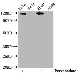 Western Blot | Positive WB detected in Hela whole cell lysate,A549 whole cell lysate(treated with Pervanadate or not) | All lanes Phospho-JAK2 antibody at 0.75μg/ml | Secondary | Goat polyclonal to rabbit IgG at 1/50000 dilution | Predicted band size: 120 KDa | Observed band size: 120 KDaPhospho-JAK2 (Y1007 + Y1008) Recombinant Monoclonal Antibody
