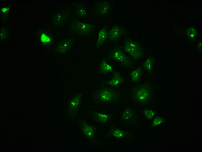 Immunofluorescence staining of A549 cells with Phospho-JUN (S63) Recombinant Monoclonal Antibody at 1:100,counter-stained with DAPI. The cells were fixed in 4% formaldehyde, permeabilized using 0.2% Triton X-100 and blocked in 10% normal Goat Serum. The cells were then incubated with the antibody overnight at 4°C. The secondary antibody was Alexa Fluor 488-congugated AffiniPure Goat Anti-Rabbit IgG (H+L).Phospho-JUN (S63) Recombinant Monoclonal Antibody