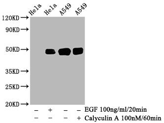 Western Blot | Positive WB detected in: Hela whole cell lysate, A549 whole cell lysate(treated with Calyculin A or EGF) | All lanes: Phospho-JUN antibody at 0.95μg/ml | Secondary | Goat polyclonal to rabbit IgG at 1/50000 dilution | Predicted band size: 48 KDa | Observed band size: 48 KDaPhospho-JUN (S63) Recombinant Monoclonal Antibody