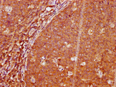 IHC image of Phospho-LAT (Y191) Recombinant Monoclonal Antibody diluted at 1:100 and staining in paraffin-embedded human tonsil tissue performed on a Leica BondTM system. After dewaxing and hydration, antigen retrieval was mediated by high pressure in a citrate buffer (pH 6.0). Section was blocked with 10% normal goat serum 30min at RT. Then primary antibody (1% BSA) was incubated at 4°C overnight. The primary is detected by a biotinylated secondary antibody and visualized using an HRP conjugated SP system.Phospho-LAT (Y191) Recombinant Monoclonal Antibody
