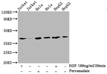 Western Blot | Positive WB detected in:Jurkat whole cell lysate, Hela whole cell lysate, HepG2 whole cell lysate(treated with EGF or Pervanadate) | All lanes: Phospho-LAT antibody at 2.9μg/ml | Secondary | Goat polyclonal to rabbit IgG at 1/50000 dilution | Predicted band size: 38 KDa | Observed band size: 38 KDaPhospho-LAT (Y191) Recombinant Monoclonal Antibody