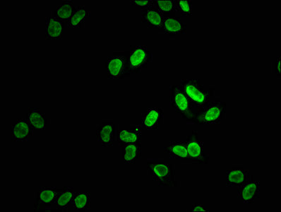 Immunofluorescence staining of Hela cells with LMNA Recombinant Monoclonal Antibody at 1:38, counter-stained with DAPI. The cells were fixed in 4% formaldehyde, permeabilized using 0.2% Triton X-100 and blocked in 10% normal Goat Serum. The cells were then incubated with the antibody overnight at 4℃. The secondary antibody was Alexa Fluor 488-congugated AffiniPure Goat Anti-Rabbit IgG (H+L).LMNA Recombinant Monoclonal Antibody