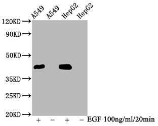 Western Blot | Positive WB detected in A549 whole cell lysate,HepG2 whole cell lysate(treated with EGF or not) | All lanes Phospho-MAPK3 antibody at 2.35μg/ml | Secondary | Goat polyclonal to rabbit IgG at 1/50000 dilution | Predicted band size: 42 KDa | Observed band size: 42 KDaPhospho-MAPK3 (T202) + MAPK1 (T185) Recombinant Monoclonal Antibody