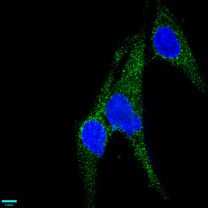 Immunofluorescence staining of U251 cells with CD146 Recombinant Monoclonal Antibody at 1:37,counter-stained with DAPI. The cells were fixed in 4% formaldehyde, permeabilized using 0.2% Triton X-100 and blocked in 10% normal Goat Serum. The cells were then incubated with the antibody overnight at 4℃.The secondary antibody was Alexa Fluor 488-congugated AffiniPure Goat Anti-Rabbit IgG (H+L).