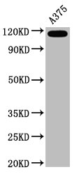Western Blot | Positive WB detected in A375 whole cell lysate | All lanes CD146 antibody at 0.6μg/ml | Secondary | Goat polyclonal to rabbit IgG at 1/50000 dilution | Predicted band size: 72 KDa | Observed band size: 120 KDa