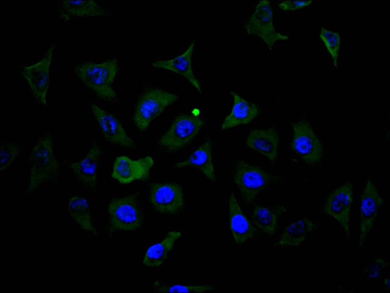 Immunofluorescence staining of MCF7 cell with MS4A1 Recombinant Monoclonal Antibody at 1:150, counter-stained with DAPI. The cells were fixed in 4% formaldehyde and blocked in 10% normal Goat Serum. The cells were then incubated with the antibody overnight at 4C. The secondary antibody was FITC-conjugated AffiniPure Goat Anti-Mouse IgG(H+L).MS4A1 Recombinant Monoclonal Antibody
