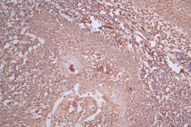 IHC image of the antibody diluted at 1:200 and staining in paraffin-embedded human tonsil tissue performed on a Leica BondTM system. After dewaxing and hydration, antigen retrieval was mediated by high pressure in a citrate buffer (pH 6.0). Section was blocked with 10% normal goat serum 30min at RT. Then primary antibody (1% BSA) was incubated at 4°C overnight. The primary is detected by a Goat anti-Mouse IgG labeled by HRP and visualized using 0.05% DAB.MS4A1 Recombinant Monoclonal Antibody