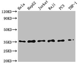 Western Blot | Positive WB detected in: Hela whole cell lysate, HepG2 whole cell lysate, Jurkat whole cell lysate, Raji whole cell lysate, PC3 whole cell lysate, THP-1 whole cell lysate | All lanes: NFKBIA antibody at 0.79μg/ml | Secondary | Goat polyclonal to rabbit IgG at 1/50000 dilution | Predicted band size: 36 KDa | Observed band size: 36 KDaNFKBIA Recombinant Monoclonal Antibody