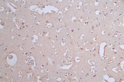 IHC image of the antibody diluted at 1:50 and staining in paraffin-embedded human brain tissue performed on a Leica BondTM system. After dewaxing and hydration, antigen retrieval was mediated by high pressure in a citrate buffer (pH 6.0). Section was blocked with 10% normal goat serum 30min at RT. Then primary antibody (1% BSA) was incubated at 4°C overnight. The primary is detected by a Goat anti-rabbit polymer IgG labeled by HRP and visualized using 0.62% DAB.PXN Recombinant Monoclonal Antibody