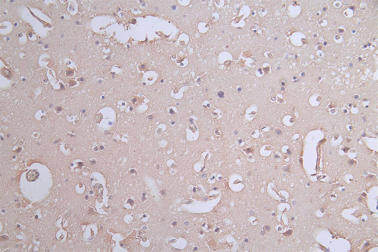 IHC image of the antibody diluted at 1:50 and staining in paraffin-embedded human brain tissue performed on a Leica BondTM system. After dewaxing and hydration, antigen retrieval was mediated by high pressure in a citrate buffer (pH 6.0). Section was blocked with 10% normal goat serum 30min at RT. Then primary antibody (1% BSA) was incubated at 4°C overnight. The primary is detected by a Goat anti-rabbit polymer IgG labeled by HRP and visualized using 0.62% DAB.PXN Recombinant Monoclonal Antibody