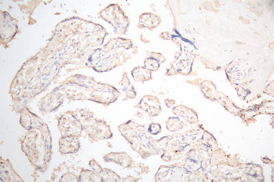 IHC image of PDPN Recombinant Monoclonal Antibody diluted at 1:300 and staining in paraffin-embedded human placenta tissue performed on a Leica BondTM system. After dewaxing and hydration, antigen retrieval was mediated by high pressure in a citrate buffer (pH 6.0). Section was blocked with 10% normal goat serum 30min at RT. Then primary antibody (1% BSA) was incubated at 4°C overnight. The primary is detected by a Goat anti-Mouse IgG labeled by HRP and visualized using 0.05% DAB.PDPN Recombinant Monoclonal Antibody