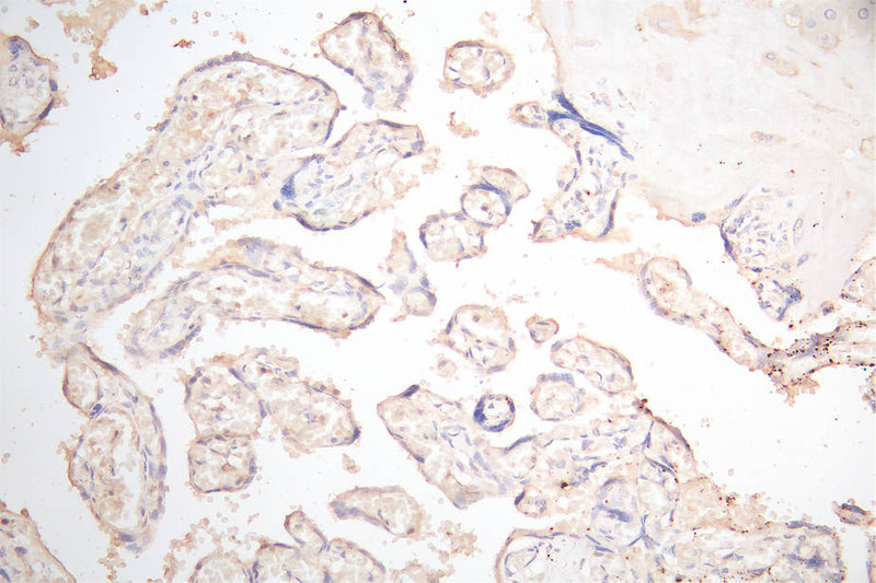 IHC image of PDPN Recombinant Monoclonal Antibody diluted at 1:300 and staining in paraffin-embedded human placenta tissue performed on a Leica BondTM system. After dewaxing and hydration, antigen retrieval was mediated by high pressure in a citrate buffer (pH 6.0). Section was blocked with 10% normal goat serum 30min at RT. Then primary antibody (1% BSA) was incubated at 4°C overnight. The primary is detected by a Goat anti-Mouse IgG labeled by HRP and visualized using 0.05% DAB.PDPN Recombinant Monoclonal Antibody