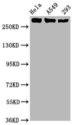 Western Blot | Positive WB detected in Hela whole cell lysate,A549 whole cell lysate,293 whole cell lysate | All lanes Phospho-POLR2A antibody at 1.02μg/ml | Secondary | Goat polyclonal to rabbit IgG at 1/50000 dilution | Predicted band size: 270 KDa | Observed band size: 270 KDaPhospho-POLR2A (S2) Recombinant Monoclonal Antibody