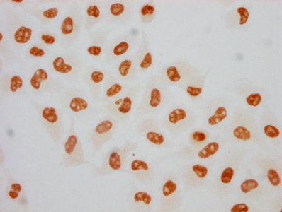 Immunocytochemistry analysis of Phospho-POLR2A (S5) Recombinant Monoclonal Antibody diluted at 1:75 and staining in Hela cells(treated with 100ng/ml EGF for 4h) performed on a Leica BondTM system. The cells were fixed in 4% formaldehyde, permeabilized using 0.2% Triton X-100 and blocked with 10% normal goat serum 30min at RT. Then primary antibody (1% BSA) was incubated at 4℃ overnight. The primary is detected by a biotinylated secondary antibody and visualized using an HRP conjugated SP system.Phospho-POLR2A (S5) Recombinant Monoclonal Antibody