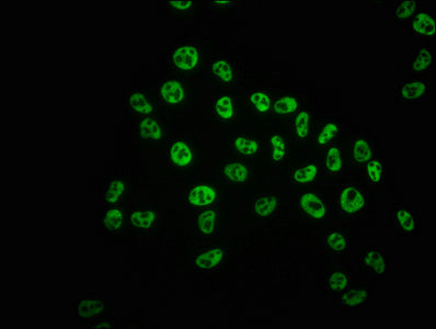 Immunofluorescence staining of Hela cells with Phospho-POLR2A (S5) Recombinant Monoclonal Antibody at 1:100,counter-stained with DAPI. The cells were fixed in 4% formaldehyde, permeabilized using 0.2% Triton X-100 and blocked in 10% normal Goat Serum. The cells were then incubated with the antibody overnight at 4℃. The secondary antibody was Alexa Fluor 488-congugated AffiniPure Goat Anti-Rabbit IgG (H+L).Phospho-POLR2A (S5) Recombinant Monoclonal Antibody