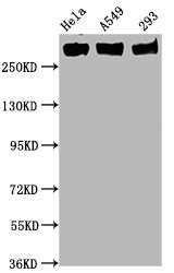 Western Blot | Positive WB detected in Hela whole cell lysate,A549 whole cell lysate,293 whole cell lysate | All lanes Phospho-POLR2A antibody at 0.75μg/ml | Secondary | Goat polyclonal to rabbit IgG at 1/50000 dilution | Predicted band size: 270 KDa | Observed band size: 270 KDaPhospho-POLR2A (S5) Recombinant Monoclonal Antibody