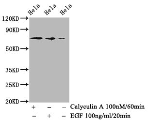 Western Blot | Positive WB detected in Hela whole cell lysate(treated with Calyculin A or EGF) | All lanes Phospho-RAF1 antibody at 1.18μg/ml | Secondary | Goat polyclonal to rabbit IgG at 1/50000 dilution | Predicted band size: 73 KDa | Observed band size: 73 KDaPhospho-RAF1 (S259) Recombinant Monoclonal Antibody
