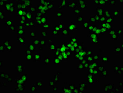 Immunofluorescence staining of K562 cells with Phospho-RB1 (S780) Recombinant Monoclonal Antibody at 1:100,counter-stained with DAPI. The cells were fixed in 4% formaldehyde, permeabilized using 0.2% Triton X-100 and blocked in 10% normal Goat Serum. The cells were then incubated with the antibody overnight at 4℃. The secondary antibody was Alexa Fluor 488-congugated AffiniPure Goat Anti-Rabbit IgG (H+L).Phospho-RB1 (S780) Recombinant Monoclonal Antibody