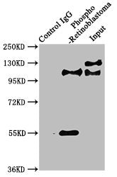 Immunoprecipitating Phospho-RB1 in Hela whole cell lysate | Lane 1: Rabbit control IgG(1μg)instead of Phospho-RB1 (S780) Recombinant Monoclonal Antibody in Hela whole cell lysate. | For western blotting,a HRP-conjugated Protein G antibody was used as the secondary antibody (1/2000) | Lane 2: Phospho-RB1 (S780) Recombinant Monoclonal Antibody(3μg)+ Hela whole cell lysate(1mg) | Lane 3: Hela whole cell lysate (20μg)Phospho-RB1 (S780) Recombinant Monoclonal Antibody