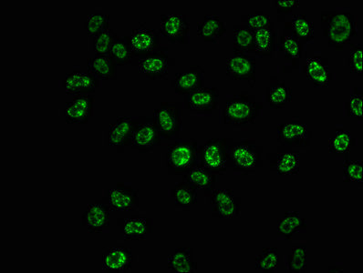 Immunofluorescence staining of Hela cells with Phospho-RPS6KB1 (T421+S424) Recombinant Monoclonal Antibody at 1:100,counter-stained with DAPI. The cells were fixed in 4% formaldehyde, permeabilized using 0.2% Triton X-100 and blocked in 10% normal Goat Serum. The cells were then incubated with the antibody overnight at 4℃. The secondary antibody was Alexa Fluor 488-congugated AffiniPure Goat Anti-Rabbit IgG (H+L).