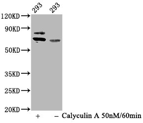 Western Blot | Positive WB detected in 293 whole cell lysate(treated with Calyculin A or not) | All lanes Phospho-RPS6KB1 antibody at 0.93μg/ml | Secondary | Goat polyclonal to rabbit IgG at 1/50000 dilution | Predicted band size: 70 KDa | Observed band size: 70 KDa