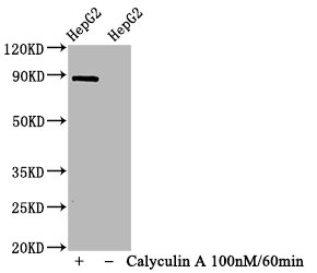 Western Blot | Positive WB detected in HepG2 whole cell lysate(treated with Calyculin A or not) | All lanes Phospho-STAT1 antibody at 1.065μg/ml | Secondary | Goat polyclonal to rabbit IgG at 1/50000 dilution | Predicted band size: 87 KDa | Observed band size: 87 KDaPhospho-STAT1 (S727) Recombinant Monoclonal Antibody