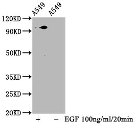 Western Blot | Positive WB detected in A549 whole cell lysate(treated with EGF or not) | All lanes Phospho-STAT3 antibody at 1.88μg/ml | Secondary | Goat polyclonal to rabbit IgG at 1/50000 dilution | Predicted band size: 98 KDa | Observed band size: 98 KDaPhospho-STAT3 (S727) Recombinant Monoclonal Antibody