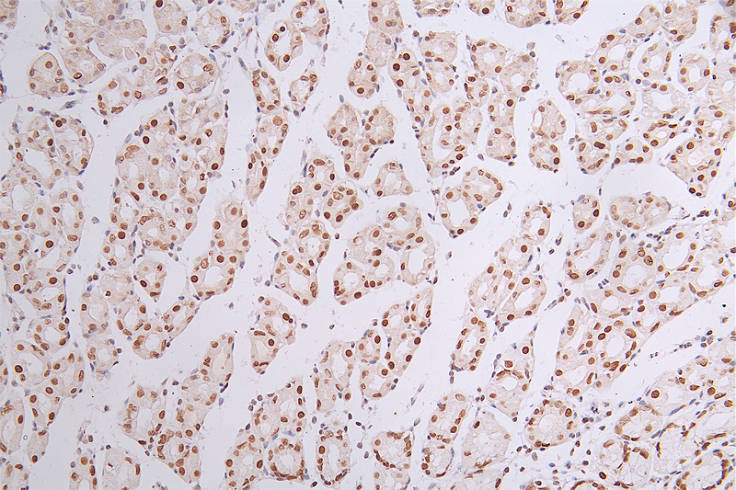 IHC image of the antibody diluted at 1:50 and staining in paraffin-embedded human stomach tissue performed on a Leica BondTM system. After dewaxing and hydration, antigen retrieval was mediated by high pressure in a citrate buffer (pH 6.0). Section was blocked with 10% normal goat serum 30min at RT. Then primary antibody (1% BSA) was incubated at 4°C overnight. The primary is detected by a Goat anti-rabbit polymer IgG labeled by HRP and visualized using 0.44% DAB.
