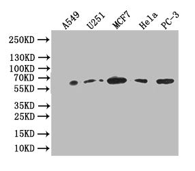 Western Blot | Positive WB detected in: A549 whole cell lysate, U251 whole cell lysate,MCF7 whole cell lysate,HELA whole cell lysate,PC-3 whole cell lysate | All lanes: Glucose 6 phosphate isomerase antibody at 1:1000 | Secondary | Goat polyclonal to rabbit IgG at 1/50000 dilution | Predicted band size: 63 kDa | Observed band size: 63 kDaGPI Recombinant Monoclonal Antibody