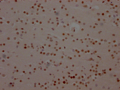 IHC image of BRD4 Recombinant Monoclonal Antibody diluted at 1:100 and staining in paraffin-embedded human brain tissue performed on a Leica BondTM system. After dewaxing and hydration, antigen retrieval was mediated by high pressure in a citrate buffer (pH 6.0). Section was blocked with 10% normal goat serum 30min at RT. Then primary antibody (1% BSA) was incubated at 4℃ overnight. The primary is detected by a Goat anti-rabbit IgG polymer labeled by HRP and visualized using 0.05% DAB.