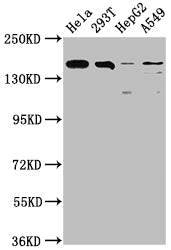 Western Blot | Positive WB detected in: Hela whole cell lysate, 293T whole cell lysate, HepG2 whole cell lysate, A549 whole cell lysate | All lanes: BRD4 antibody at 1:1500 | Secondary | Goat polyclonal to rabbit IgG at 1/50000 dilution | Predicted band size: 153, 81, 89 kDa | Observed band size: 153 kDa