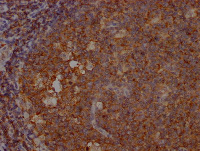 IHC image of INPP5D Recombinant Monoclonal Antibody diluted at 1:100 and staining in paraffin-embedded human tonsil tissue performed on a Leica BondTM system. After dewaxing and hydration, antigen retrieval was mediated by high pressure in a citrate buffer (pH 6.0). Section was blocked with 10% normal goat serum 30min at RT. Then primary antibody (1% BSA) was incubated at 4℃ overnight. The primary is detected by a Goat anti-rabbit IgG polymer labeled by HRP and visualized using 0.05% DAB.INPP5D Recombinant Monoclonal Antibody