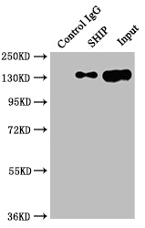 Immunoprecipitating SHIP in Raji whole cell lysate | Lane 1: Rabbit control IgG instead of INPP5D Recombinant Monoclonal Antibody in Raji whole cell lysate. | For western blotting,a HRP-conjugated Protein G antibody was used as the secondary antibody (1/2000) | Lane 2: INPP5D Recombinant Monoclonal Antibody(2µg)+ Raji whole cell lysate(500µg) | Lane 3: Raji whole cell lysate (10µg)INPP5D Recombinant Monoclonal Antibody