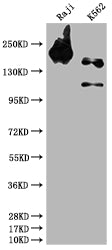 Western Blot | Positive WB detected in: Raji whole cell lysate, K562 whole cell lysate | All lanes: INPP5D antibody at 1:1500 | Secondary | Goat polyclonal to rabbit IgG at 1/50000 dilution | Predicted band size: 134, 110 kDa | Observed band size: 145 kDaINPP5D Recombinant Monoclonal Antibody