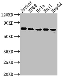 Western Blot | Positive WB detected in: Jurkat whole cell lysate, K562 whole cell lysate, Hela whole cell lysate, Raji whole cell lysate, HepG2 whole cell lysate | All lanes: FUBP1 antibody at 1:2000 | Secondary | Goat polyclonal to rabbit IgG at 1/50000 dilution | Predicted band size: 68, 69 kDa | Observed band size: 69 kDaFUBP1 Recombinant Monoclonal Antibody