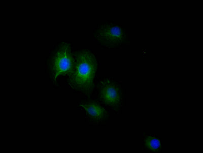 Immunofluorescence staining of A549 Cells with EGFR Recombinant Monoclonal Antibody at 1:50, counter-stained with DAPI. The cells were fixed in 4% formaldehyde, permeated by 0.2% TritonX-100, and blocked in 10% normal Goat Serum. The cells were then incubated with the antibody overnight at 4℃. Nuclear DNA was labeled in blue with DAPI. The secondary antibody was FITC-conjugated AffiniPure Goat Anti-Rabbit IgG (H+L).