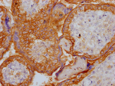 IHC image of EGFR Recombinant Monoclonal Antibody diluted at 1:100 and staining in paraffin-embedded human placenta tissue performed on a Leica BondTM system. After dewaxing and hydration, antigen retrieval was mediated by high pressure in a citrate buffer (pH 6.0). Section was blocked with 10% normal goat serum 30min at RT. Then primary antibody (1% BSA) was incubated at 4℃ overnight. The primary is detected by a Goat anti-rabbit IgG polymer labeled by HRP and visualized using 0.05% DAB.