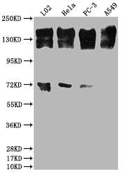 Western Blot | Positive WB detected in: L02 whole cell lysate, Hela whole cell lysate, PC-3 whole cell lysate, A549 whole cell lysate | All lanes: EGFR antibody at 1:2000 | Secondary | Goat polyclonal to rabbit IgG at 1/50000 dilution | Predicted band size: 135, 45, 78, 70 kDa | Observed band size: 165 kDa