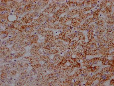 IHC image of ATP5A1 Recombinant Monoclonal Antibody diluted at 1:100 and staining in paraffin-embedded human liver tissue performed on a Leica BondTM system. After dewaxing and hydration, antigen retrieval was mediated by high pressure in a citrate buffer (pH 6.0). Section was blocked with 10% normal goat serum 30min at RT. Then primary antibody (1% BSA) was incubated at 4℃ overnight. The primary is detected by a Goat anti-rabbit IgG polymer labeled by HRP and visualized using 0.05% DAB.ATP5A1 Recombinant Monoclonal Antibody