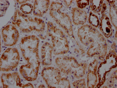 IHC image of ATP5A1 Recombinant Monoclonal Antibody diluted at 1:100 and staining in paraffin-embedded human kidney tissue performed on a Leica BondTM system. After dewaxing and hydration, antigen retrieval was mediated by high pressure in a citrate buffer (pH 6.0). Section was blocked with 10% normal goat serum 30min at RT. Then primary antibody (1% BSA) was incubated at 4℃ overnight. The primary is detected by a Goat anti-rabbit IgG polymer labeled by HRP and visualized using 0.05% DAB.ATP5A1 Recombinant Monoclonal Antibody