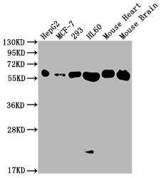 Western Blot | Positive WB detected in: HepG2 whole cell lysate, MCF-7 whole cell lysate, 293 whole cell lysate, HL60 whole cell lysate, Mouse Heart tissue, Mouse Brain tissue | All lanes: ATP5F1A antibody at 1:2000 | Secondary | Goat polyclonal to rabbit IgG at 1/50000 dilution | Predicted band size: 60, 55, 58 kDa | Observed band size: 60 kDaATP5A1 Recombinant Monoclonal Antibody