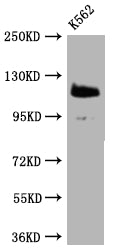 Western Blot | Positive WB detected in: K562 whole cell lysate | All lanes: PARP antibody at 1:2000 | Secondary | Goat polyclonal to rabbit IgG at 1/50000 dilution | Predicted band size: 114 kDa | Observed band size: 114 kDaPARP1 Recombinant Monoclonal Antibody