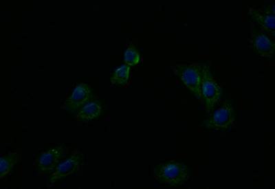 Immunofluorescence staining of HepG2 with ATP7B Recombinant Monoclonal Antibody at 1:20, counter-stained with DAPI. The cells were fixed in 4% formaldehyde and blocked in 10% normal Goat Serum. The cells were then incubated with the antibody overnight at 4°C. The secondary antibody was Alexa Fluor 494-congugated AffiniPure Goat Anti-Rabbit IgG(H+L).ATP7B Recombinant Monoclonal Antibody