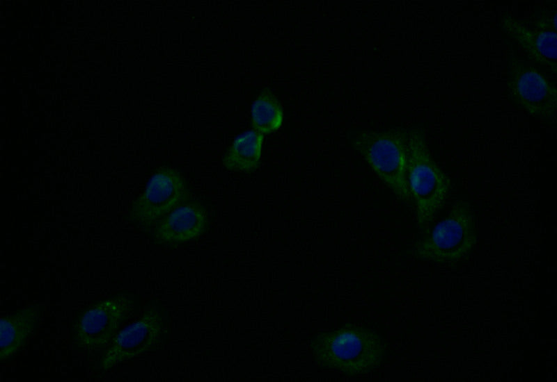 Immunofluorescence staining of HepG2 with ATP7B Recombinant Monoclonal Antibody at 1:20, counter-stained with DAPI. The cells were fixed in 4% formaldehyde and blocked in 10% normal Goat Serum. The cells were then incubated with the antibody overnight at 4°C. The secondary antibody was Alexa Fluor 494-congugated AffiniPure Goat Anti-Rabbit IgG(H+L).ATP7B Recombinant Monoclonal Antibody