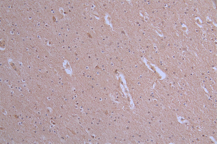 IHC image of the antibody diluted at 1:50 and staining in paraffin-embedded human brain tissue performed on a Leica BondTM system. After dewaxing and hydration, antigen retrieval was mediated by high pressure in a citrate buffer (pH 6.0). Section was blocked with 10% normal goat serum 30min at RT. Then primary antibody (1% BSA) was incubated at 4°C overnight. The primary is detected by a Goat anti-rabbit polymer IgG labeled by HRP and visualized using 0.19% DAB.ATP7B Recombinant Monoclonal Antibody