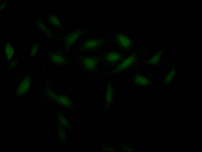 Immunofluorescence staining of Hela Cells with CHEK1 Recombinant Monoclonal Antibody at 1:50, counter-stained with DAPI. The cells were fixed in 4% formaldehyde, permeated by 0.2% TritonX-100, and blocked in 10% normal Goat Serum. The cells were then incubated with the antibody overnight at 4℃. Nuclear DNA was labeled in blue with DAPI. The secondary antibody was FITC-conjugated AffiniPure Goat Anti-Rabbit IgG (H+L).